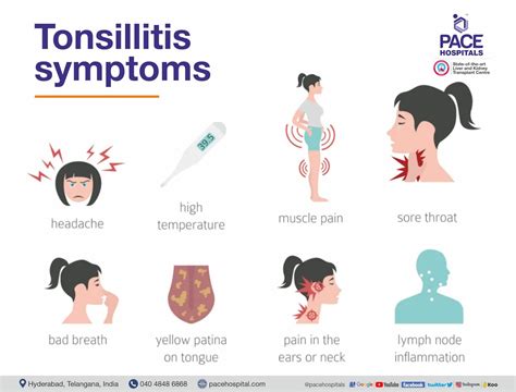 Adenotonsillitis Symptoms Diagnosis And Treatment