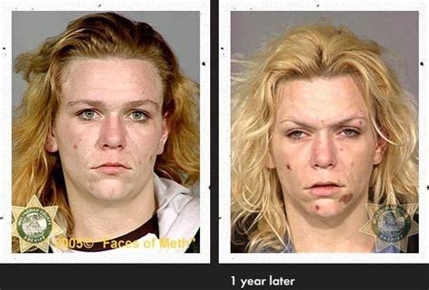 Meth Heads Before And After Gallery Ebaum S World
