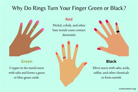 Why Do Rings Turn Your Finger Green Or Black