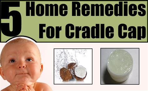 Best Home Remedies For Cradle Cap Natural Home Remedies And Supplements