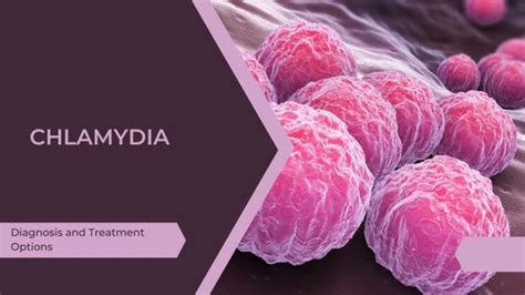 Ultimate Guide To Chlamydia Diagnosis And Treatment Options