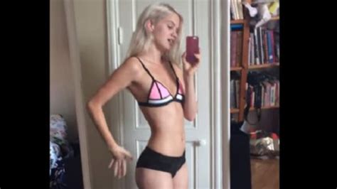 Swedish Model Agnes Hedengard 19 Branded ‘too Big Hits Out At