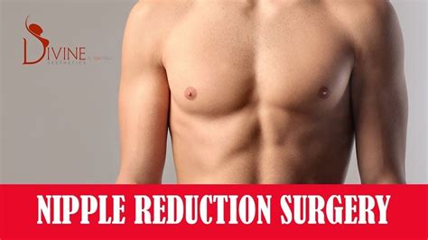 What Is Nipple Reduction Nipple Reduction Surgery Plastic Surgery In India Youtube