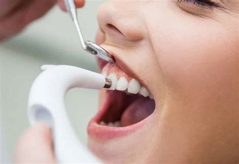 The Benefits Of Dental Polishing A Comprehensive Guide