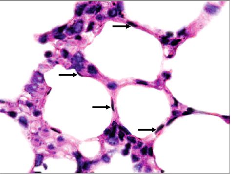 Lung Alveoli Histology