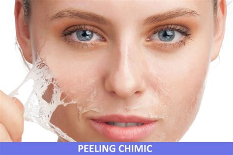 Peeling Chimic Facial Medical Dr Dana Bratu