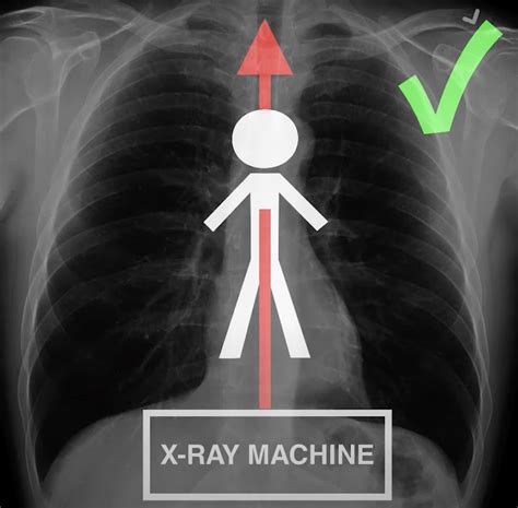 Chest X Ray For Students How To Interpret And Present Methodically
