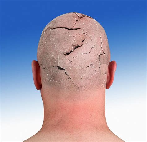 Person With Cracked Head Photograph By Victor De Schwanbergscience