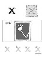 Aliexpress carries many picture for kindergarten related products, including 152 cm film , corner flower sticker , hanger. The Alphabet - The Letter X - Kindergarten Resources