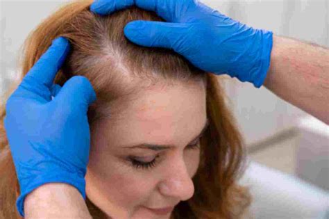 What Are The Most Common Causes Of Hair Loss