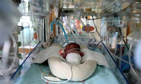 Health Very Premature Or Low Birth Weight Babies Are More Likely To
