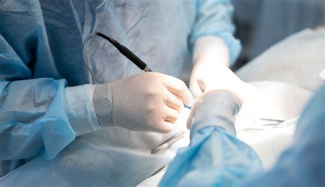 Abdominal Incision Stock Photos Free And Royalty Free Stock Photos From