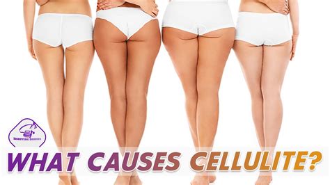 what causes cellulite and how to get rid of cellulite get rid of cellulite youtube