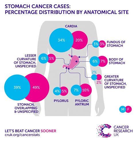 6 Warning Signs Of Stomach Cancer Beautyhealthycare