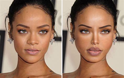 10 Celebrities Faces Before And After Surgery Celebrity Gossip