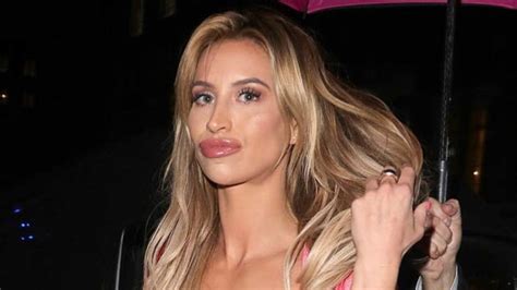 Ferne Mccann Shows Off Dramatic Transformation With Very Plump Pout