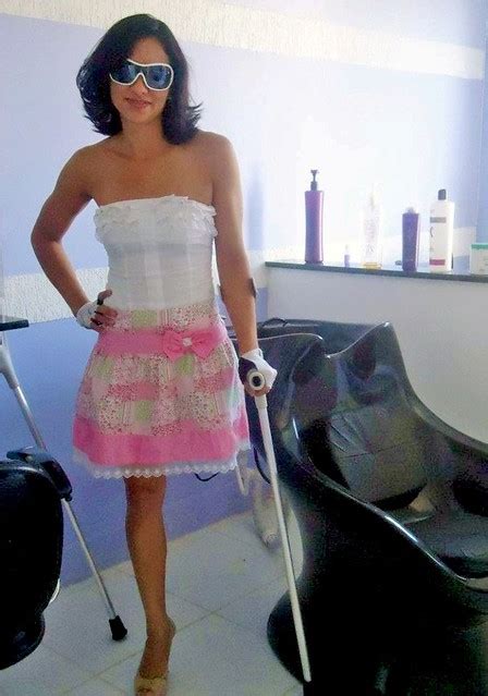 Marinalva De Almeida Beautiful Woman Amputee Leg Crutches A Photo On