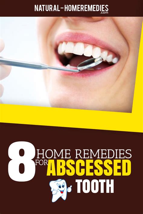 8 Natural Home Remedies For Treating Tooth Abscess Common Causes And
