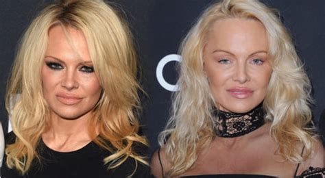 As Ha Sido El Incre Ble Cambio De Cara De Pamela Anderson Los