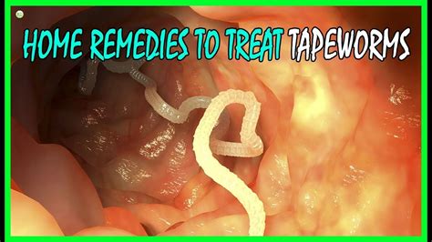 4 Effective Home Remedies To Treat Tapeworms In Humans Best Home