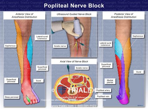 Popliteal Nerve Block Trial Exhibits Inc