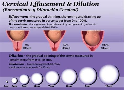 Cervical Dilation Chart Dilation And Effacement Student Midwife
