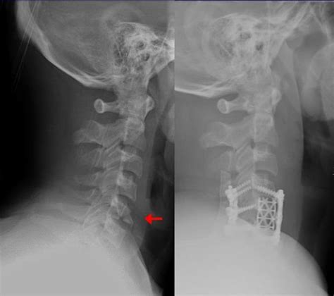 Learn how this test works, as well as its benefits and risks. Orthopedic surgery - Wikipedia