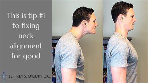 Step 1 For Improving Neck Posture And Alignment Youtube