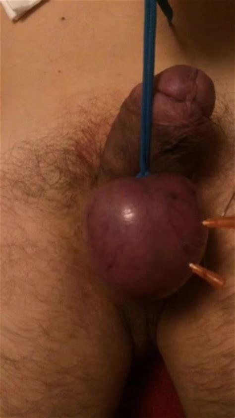 Brutal Ball Needle Torture Gay Bizarre Porn At Thisvid Tube