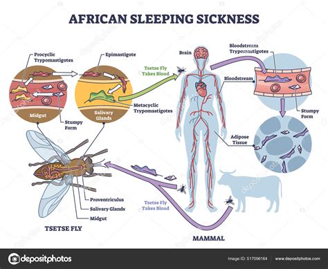 African Sleeping Sickness Or African Trypanosomiasis Illustration Diagram Stock Vector Image By