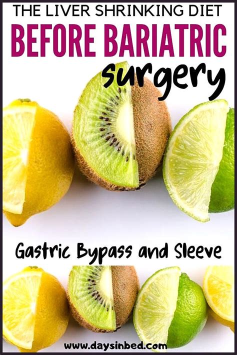 Liver Shrinking Diet For Gastric Bypass Patients Days In Bed Liver