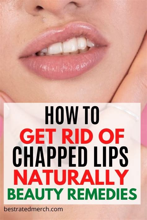 10 Home Remedies To Get Rid Of Chapped Lips Fast Dry Lips Remedy Chapped Lips Remedy Lips