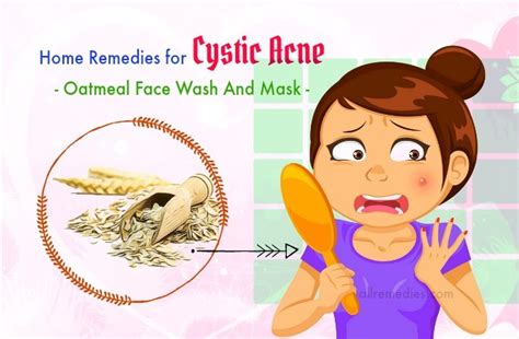 Cystic Acne Pregnancy Symptom Acne Symptoms