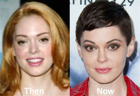 Rose Mcgowan Plastic Surgery Before And After Photos
