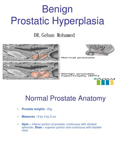 PDF Benign Prostatic Hyperplasia Ggb DOKUMEN TIPS