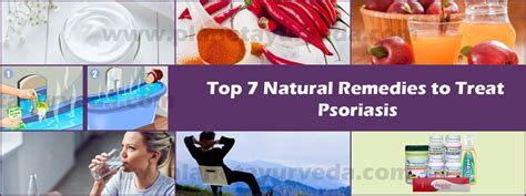 Top 7 Natural Remedies To Treat Psoriasis