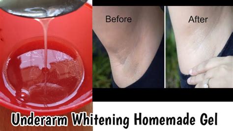 Underarm Whitening Gel At Home Easily Get Rid Of Underarm Darkness At