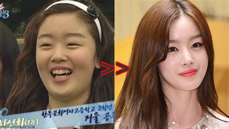 Korean Idol Plastic Surgery Telegraph