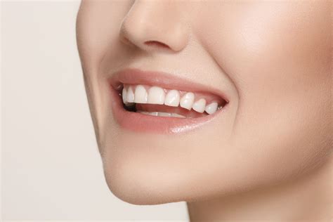 Veneers Smile Core Dental Specialty Group