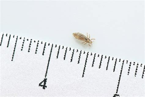 Worlds Biggest Head Lice