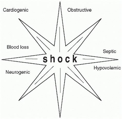 6 Types Of Shock