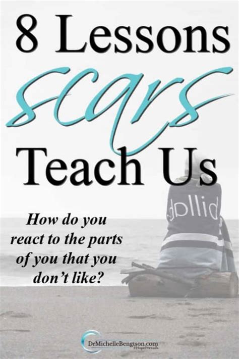 8 Lessons Scars Teach Us Dr Michelle Bengtson