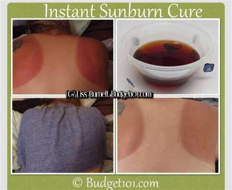 instant sunburn relief turn your sunburn into a tan instantly trusper