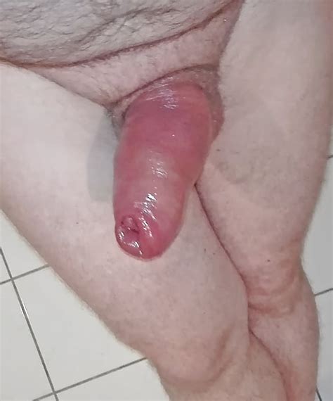 swollen penis 8 pics xhamster