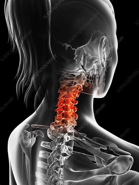Human Cervical Spine Pain Illustration Stock Image F0127076