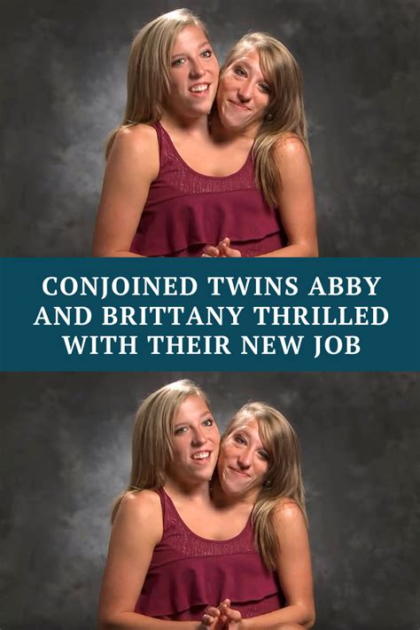 abby and brittany hensel conjoined twins sex life ripase