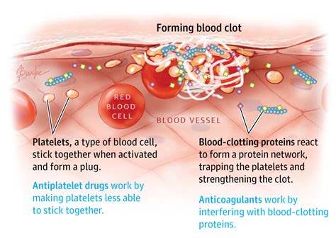 Blood Thinners Patient Information Jama Jama Network