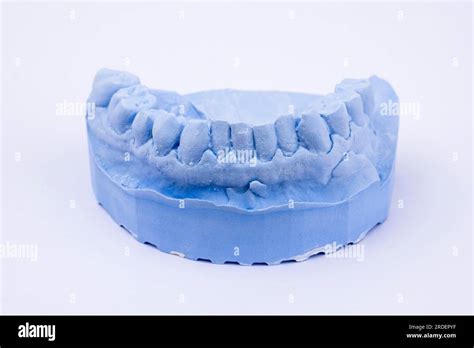 Denture Impression Of An Upper Jaw For Dentures Dentist Dental