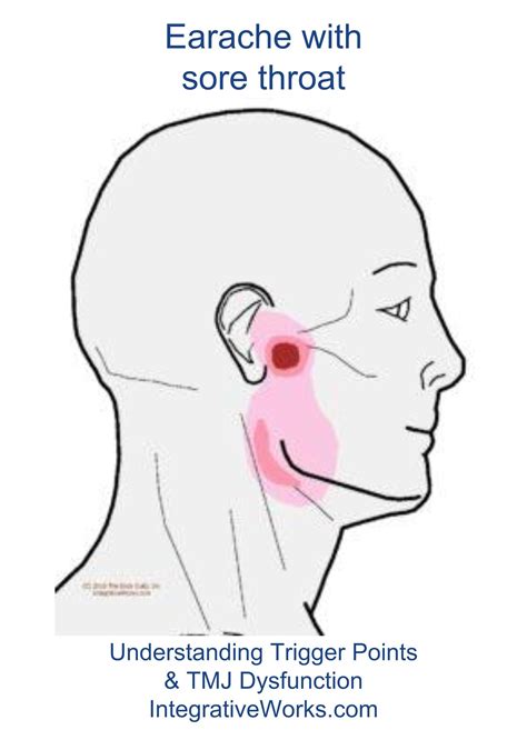 Pin On Throat Trigger Point Pain