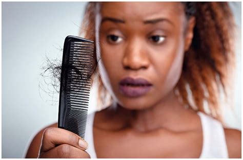 What To Know About Hair Loss As A Black Woman Truelove